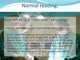 Normal reading:
 