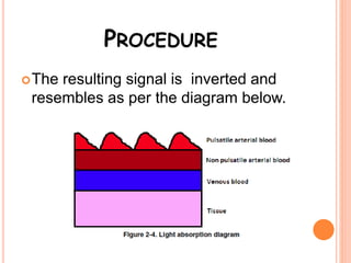 PROCEDURE
The resulting signal is inverted and
resembles as per the diagram below.
 