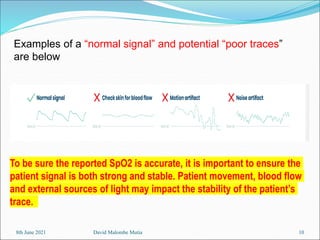 Poor Spo2 Waveform Notes on the Pulse Oximetry in medical engineering | PPT