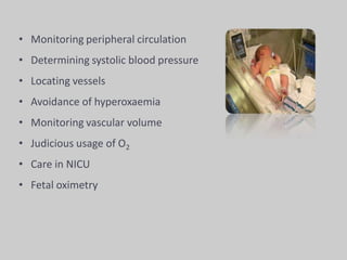 • Monitoring peripheral circulation
• Determining systolic blood pressure
• Locating vessels
• Avoidance of hyperoxaemia
• Monitoring vascular volume
• Judicious usage of O2
• Care in NICU
• Fetal oximetry
 