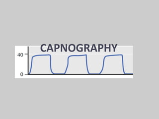 CAPNOGRAPHY
 