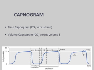 CAPNOGRAM
• Time Capnogram (CO2 versus time)
• Volume Capnogram (CO2 versus volume )
 