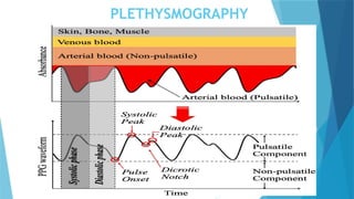 PLETHYSMOGRAPHY
 