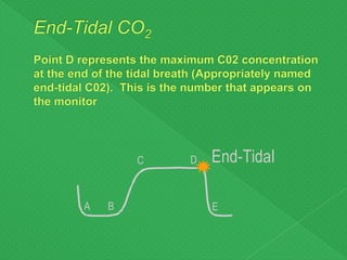 A B
C D
E
End-Tidal
 