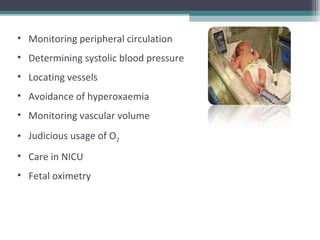 • Monitoring peripheral circulation
• Determining systolic blood pressure
• Locating vessels
• Avoidance of hyperoxaemia
• Monitoring vascular volume
• Judicious usage of O2
• Care in NICU
• Fetal oximetry
 