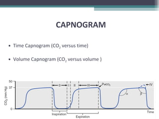 CAPNOGRAM
• Time Capnogram (CO2 versus time)
• Volume Capnogram (CO2 versus volume )
 