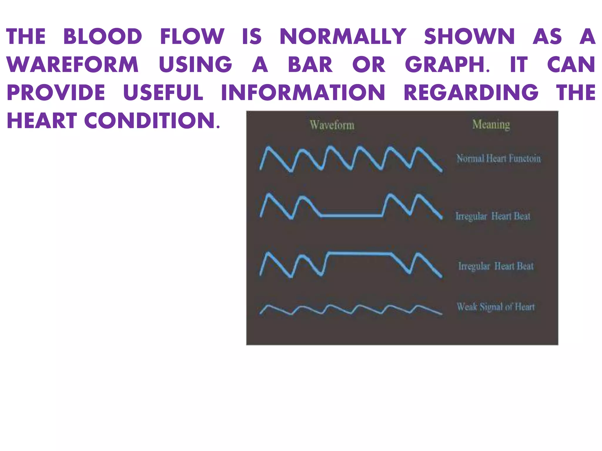 THE BLOOD FLOW IS NORMALLY SHOWN AS A
WAREFORM USING A BAR OR GRAPH. IT CAN
PROVIDE USEFUL INFORMATION REGARDING THE
HEART CONDITION.
 