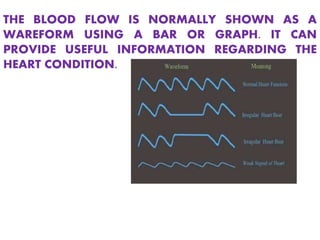 THE BLOOD FLOW IS NORMALLY SHOWN AS A
WAREFORM USING A BAR OR GRAPH. IT CAN
PROVIDE USEFUL INFORMATION REGARDING THE
HEART CONDITION.
 