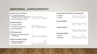 ABNORMAL CAPNOGRAPHY
 