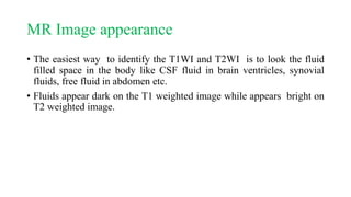 MR Image appearance
• The easiest way to identify the T1WI and T2WI is to look the fluid
filled space in the body like CSF fluid in brain ventricles, synovial
fluids, free fluid in abdomen etc.
• Fluids appear dark on the T1 weighted image while appears bright on
T2 weighted image.
 