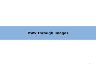 PWV through images




                     19
 