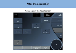 After the acquisition


New page of the Touchscreen
 