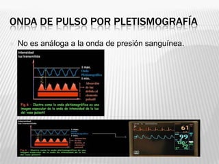ONDA DE PULSO POR PLETISMOGRAFÍA
   No es análoga a la onda de presión sanguínea.
 