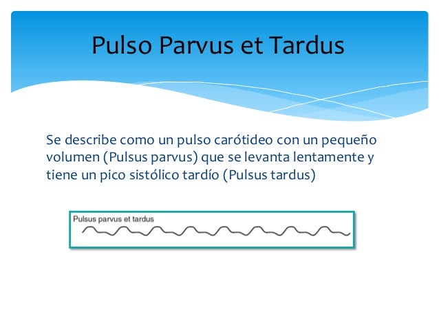 Tipos de pulso
