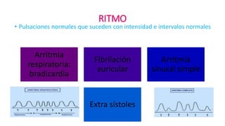 RITMO
• Pulsaciones normales que suceden con intensidad e intervalos normales
Arritmia
respiratoria:
bradicardia
Fibrilación
auricular
Arritmia
sinusal simple
Extra sístoles
 