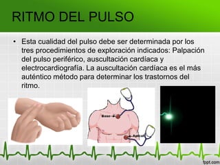 RITMO DEL PULSO
• Esta cualidad del pulso debe ser determinada por los
tres procedimientos de exploración indicados: Palpación
del pulso periférico, auscultación cardíaca y
electrocardiografía. La auscultación cardíaca es el más
auténtico método para determinar los trastornos del
ritmo.
 