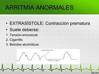 ARRITMIA ANORMALES
• EXTRASÍSTOLE: Contracción prematura
• Suele deberse:
1. Tensión emocional
2. Cigarrillo
3. Bebidas alcohólicas
 