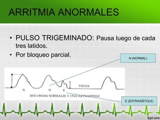 ARRITMIA ANORMALES
• PULSO TRIGEMINADO: Pausa luego de cada
tres latidos.
• Por bloqueo parcial. N (NORMAL)
E (EXTRASÍSTOLE)
 