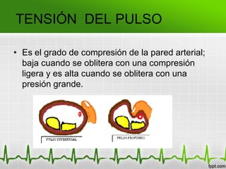 • Es el grado de compresión de la pared arterial;
baja cuando se oblitera con una compresión
ligera y es alta cuando se oblitera con una
presión grande.
TENSIÓN DEL PULSO
 