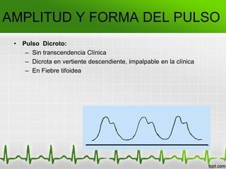 AMPLITUD Y FORMA DEL PULSO
• Pulso Dicroto:
– Sin transcendencia Clínica
– Dicrota en vertiente descendiente, impalpable en la clínica
– En Fiebre tifoidea
 