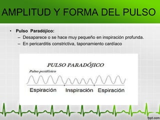 AMPLITUD Y FORMA DEL PULSO
• Pulso Paradójico:
– Desaparece o se hace muy pequeño en inspiración profunda.
– En pericarditis constrictiva, taponamiento cardíaco
 