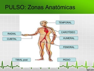 PULSO: Zonas Anatómicas
TEMPORAL
RADIAL
CAROTÍDEO
HUMERAL
FEMORAL
PEDIO
CUBITAL
TIBIAL post
 