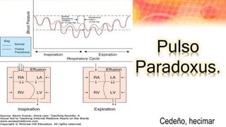 Pulso
Paradoxus.
Cedeño, hecimar
 