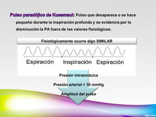 Fisiológicamente ocurre algo SIMILAR

Presión Intratorácica
Presión arterial < 10 mmHg
Amplitud del pulso

 