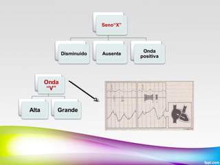 Pulso arterial y venoso
