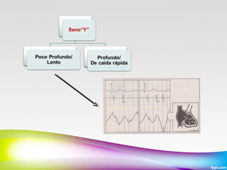 Pulso arterial y venoso