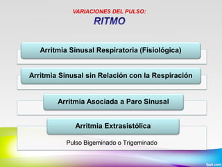 Pulso Bigeminado o Trigeminado

 