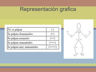 Representación grafica