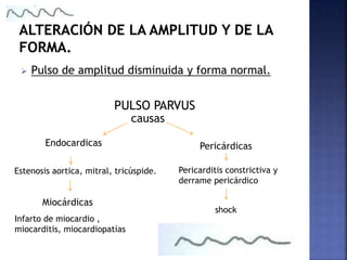  Pulso de amplitud disminuida y forma normal.
PULSO PARVUS
causas
Endocardicas
Estenosis aortica, mitral, tricúspide.
Miocárdicas
Infarto de miocardio ,
miocarditis, miocardiopatías
Pericárdicas
Pericarditis constrictiva y
derrame pericárdico
shock
 