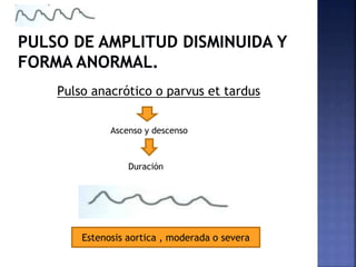 Pulso anacrótico o parvus et tardus
Ascenso y descenso
Duración
Estenosis aortica , moderada o severa
 