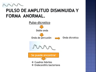 Doble onda
Se puede encontrar
 Cuadros febriles
 Endocarditis bacteriana
Onda de percusión Onda dicrotica
Pulso dicrotico
 
