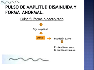 Pulso filiforme o decapitado
Baja amplitud
shock Palpación suave
Existe alteración en
la presión del pulso.
 