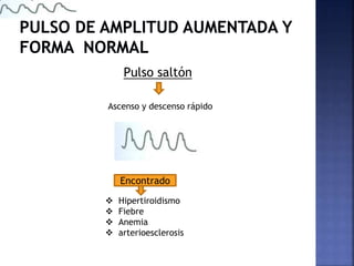 Pulso saltón
Ascenso y descenso rápido
Encontrado
 Hipertiroidismo
 Fiebre
 Anemia
 arterioesclerosis
 