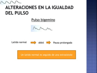 Pulso bigemino
Latido normal débil Pausa prolongada
Un latido normal es seguido de una extrasístole
 