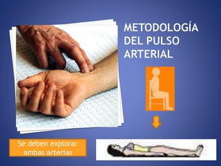 Se deben explorar
ambas arterias
 