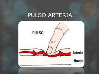 PULSO ARTERIAL
 