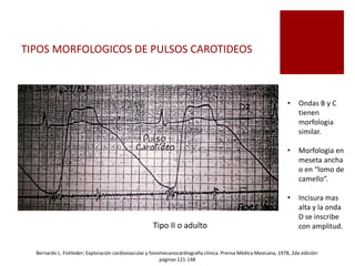 TIPOS MORFOLOGICOS DE PULSOS CAROTIDEOS
Tipo II o adulto
• Ondas B y C
tienen
morfologia
similar.
• Morfologia en
meseta ancha
o en “lomo de
camello”.
• Incisura mas
alta y la onda
D se inscribe
con amplitud.
Bernardo L. Fishleder; Exploración cardiovascular y fonomecanocardiografía clínica. Prensa Médica Mexicana, 1978, 2da edición:
paginas 121-148
 