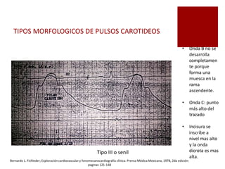 TIPOS MORFOLOGICOS DE PULSOS CAROTIDEOS
Tipo III o senil
• Onda B no se
desarrolla
completamen
te porque
forma una
muesca en la
rama
ascendente.
• Onda C: punto
más alto del
trazado
• Incisura se
inscribe a
nivel mas alto
y la onda
dicrota es mas
alta.
Bernardo L. Fishleder; Exploración cardiovascular y fonomecanocardiografía clínica. Prensa Médica Mexicana, 1978, 2da edición:
paginas 121-148
 