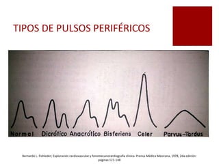 TIPOS DE PULSOS PERIFÉRICOS
Bernardo L. Fishleder; Exploración cardiovascular y fonomecanocardiografía clínica. Prensa Médica Mexicana, 1978, 2da edición:
paginas 121-148
 