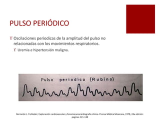 PULSO PERIÓDICO
 Oscilaciones periodicas de la amplitud del pulso no
relacionadas con los movimientos respiratorios.
 Uremia e hipertensión maligna.
Bernardo L. Fishleder; Exploración cardiovascular y fonomecanocardiografía clínica. Prensa Médica Mexicana, 1978, 2da edición:
paginas 121-148
 