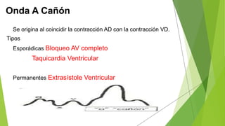 Onda A Cañón
Se origina al coincidir la contracción AD con la contracción VD.
Tipos
Esporádicas Bloqueo AV completo
Taquicardia Ventricular
Permanentes Extrasístole Ventricular
 
