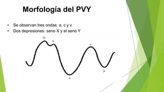 Morfología del PVY
• Se observan tres ondas: a, c y v
• Dos depresiones: seno X y el seno Y
 