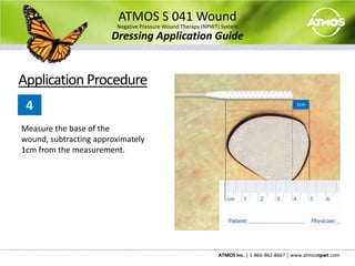 Most facilities employ a Monday, Wednesday, Friday dressing change schedule.