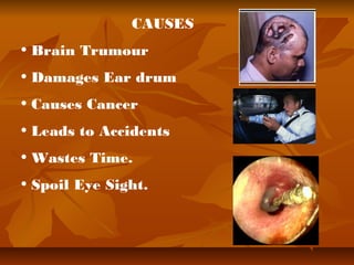 CAUSES 
• Brain Trumour 
• Damages Ear drum 
• Causes Cancer 
• Leads to Accidents 
• Wastes Time. 
• Spoil Eye Sight. 
 