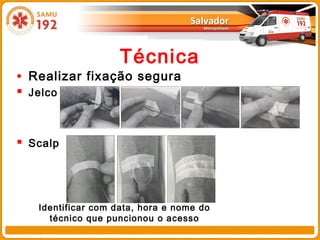Técnica
• Realizar fixação segura
 Jelco


 Scalp




   Identificar com data, hora e nome do
     técnico que puncionou o acesso
 