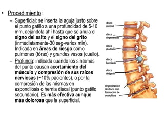 • Procedimiento:
– Superficial: se inserta la aguja justo sobre
el punto gatillo a una profundidad de 5-10
mm, dejándola ahí hasta que se anula el
signo del salto y el signo del grito
(inmediatamente-30 seg-varios min).
Indicada en áreas de riesgo como
pulmones (tórax) y grandes vasos (cuello).
– Profunda: indicada cuando los síntomas
del punto causan acortamiento del
músculo y compresión de sus raíces
nerviosas (~10% pacientes), o por la
compresión de las mismas en
espondilosis o hernia discal (punto gatillo
secundario). Es más efectiva aunque
más dolorosa que la superficial.
 